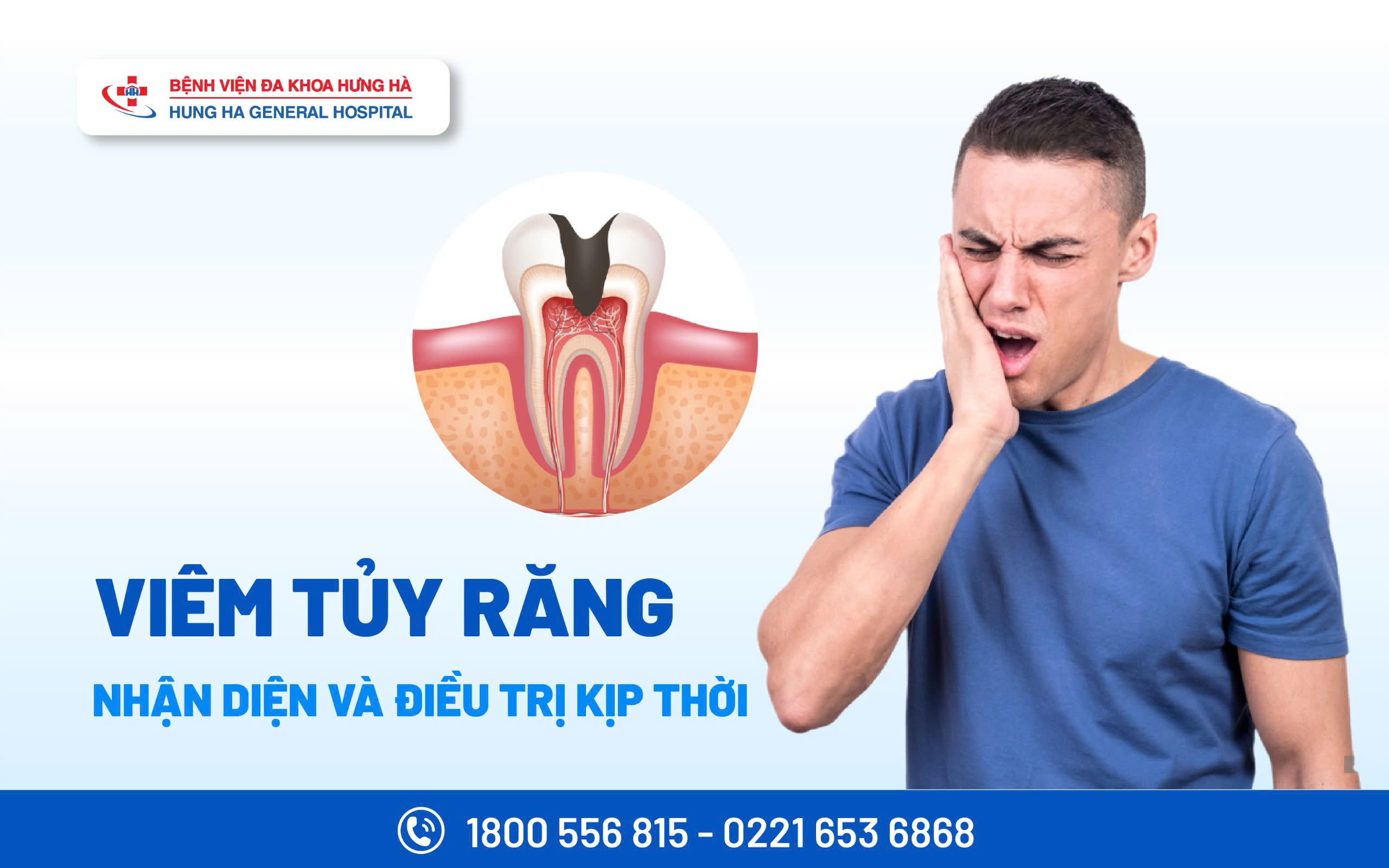 DẤU HIỆU VIÊM TỦY RĂNG: NHẬN DIỆN VÀ ĐIỀU TRỊ KỊP THỜI