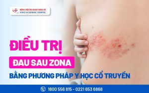 ĐIỀU TRỊ ĐAU SAU ZONA BẰNG PP Y HỌC CỔ TRUYỀN