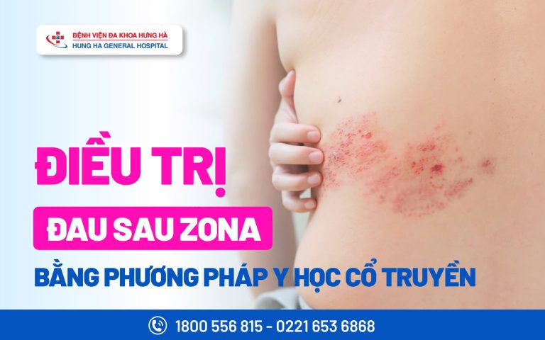 ĐIỀU TRỊ ĐAU SAU ZONA BẰNG PP Y HỌC CỔ TRUYỀN
