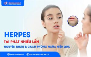 Herpes tái phát nhiều lần - Vì sao mãi không khỏi?