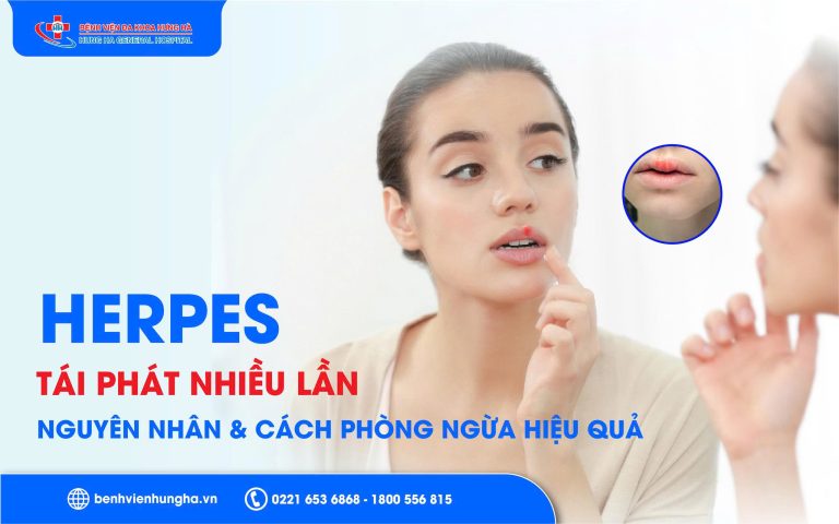 Herpes tái phát nhiều lần - Vì sao mãi không khỏi?