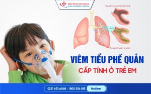 viêm tiểu phế quản cấp ở trẻ em
